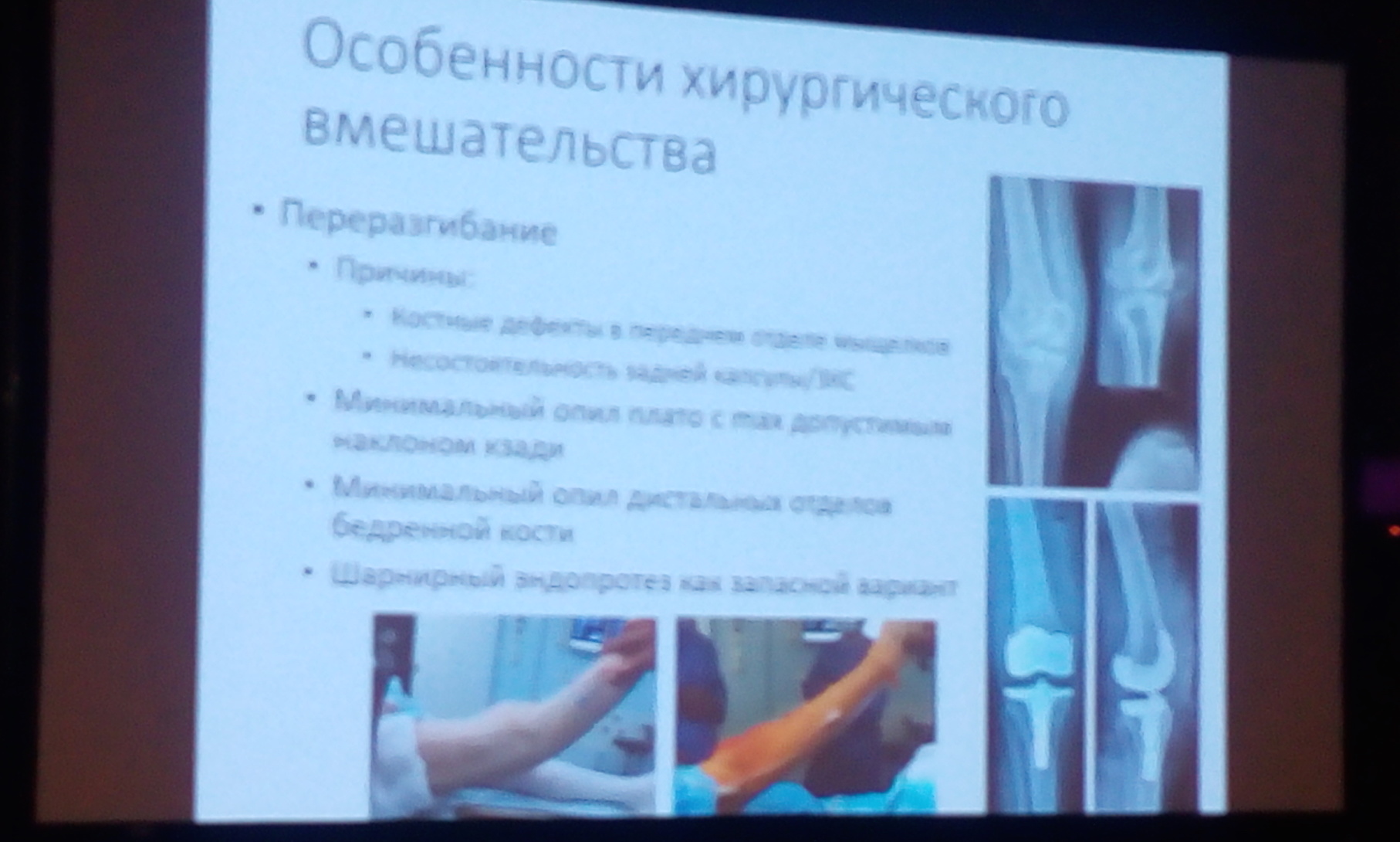 Демонстрация доклада по эндопротезирование коленного сустава